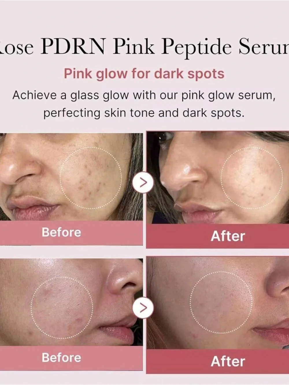 2 Pcs Medicube PDRN Pink Peptide Serum - Pink